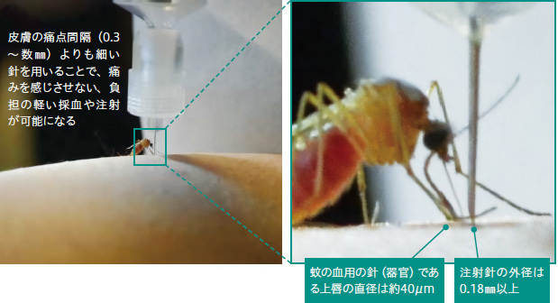 画像：医療の現場で望まれている「痛みが少ない注射針」の開発を目指す